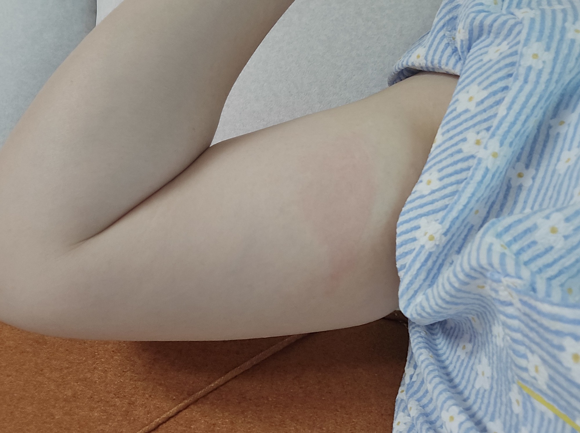 APS알쓰패치